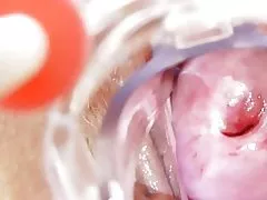 Гатэль La enfermera cochina ГП кайда ў солас